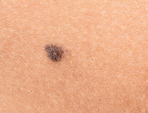 Window Film Can Reduce Skin-Cancer Risk: What the Science Says